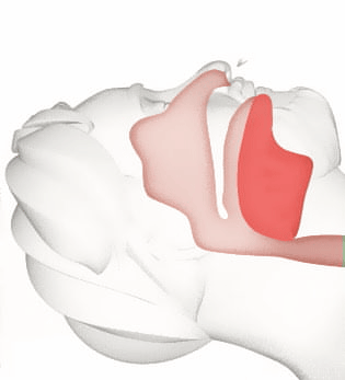 The image is a 3D rendering of a human head in a sleeping position showing how the airway moves during sleep.